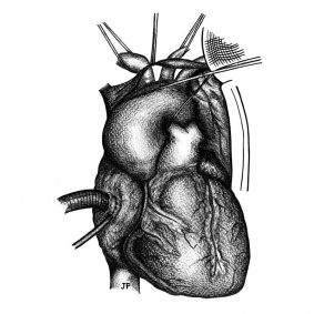 armaro cardiochirurgo
